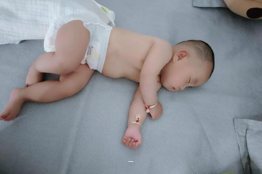 赣州宝宝脸上有白色斑块